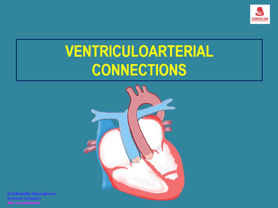 Feta Echocardiography – Ventriculoarterial Connections