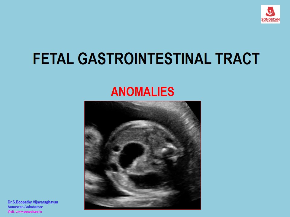 Anomalies  of Fetal Gastrointestinal Tract