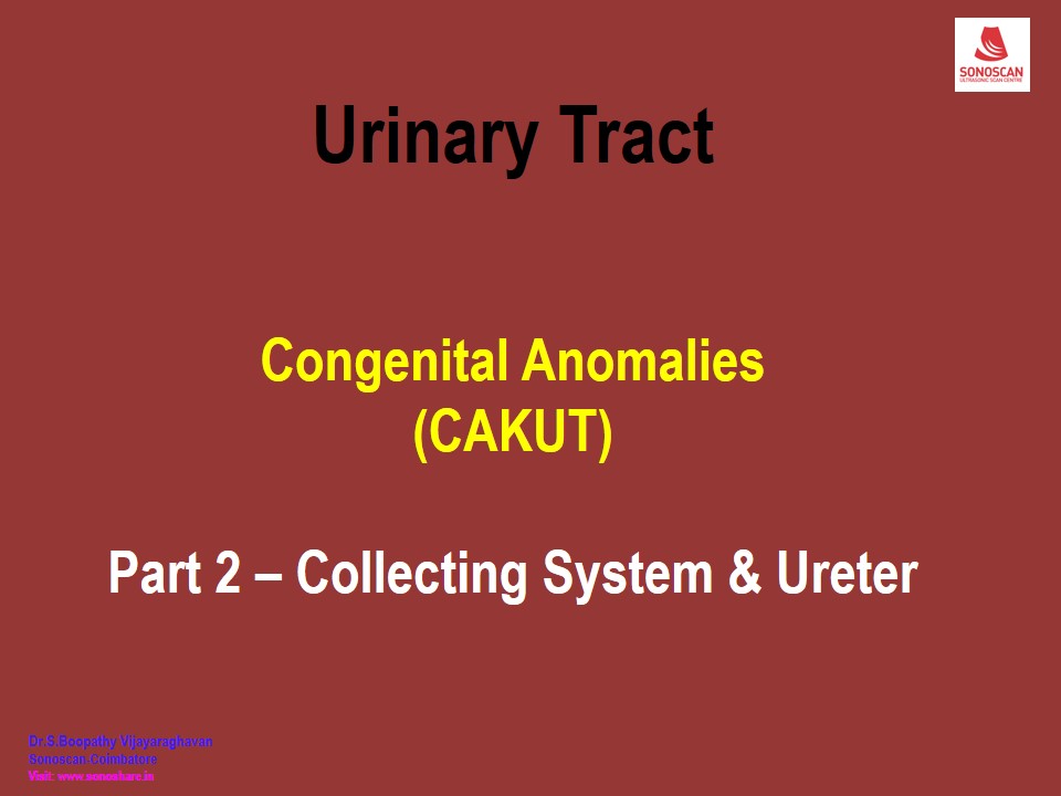 Sonography of Congenital Anomalies in Urinary Tract – Part 2 – Collecting system & Ureter
