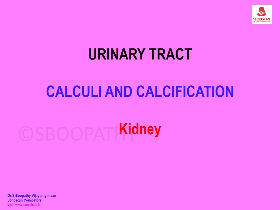 Sonography of Calcifications in Urinary Tract – Part 1 - Kidney