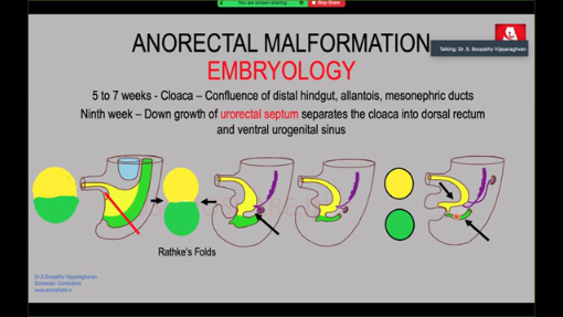 Fetal Anorectal Malformation
