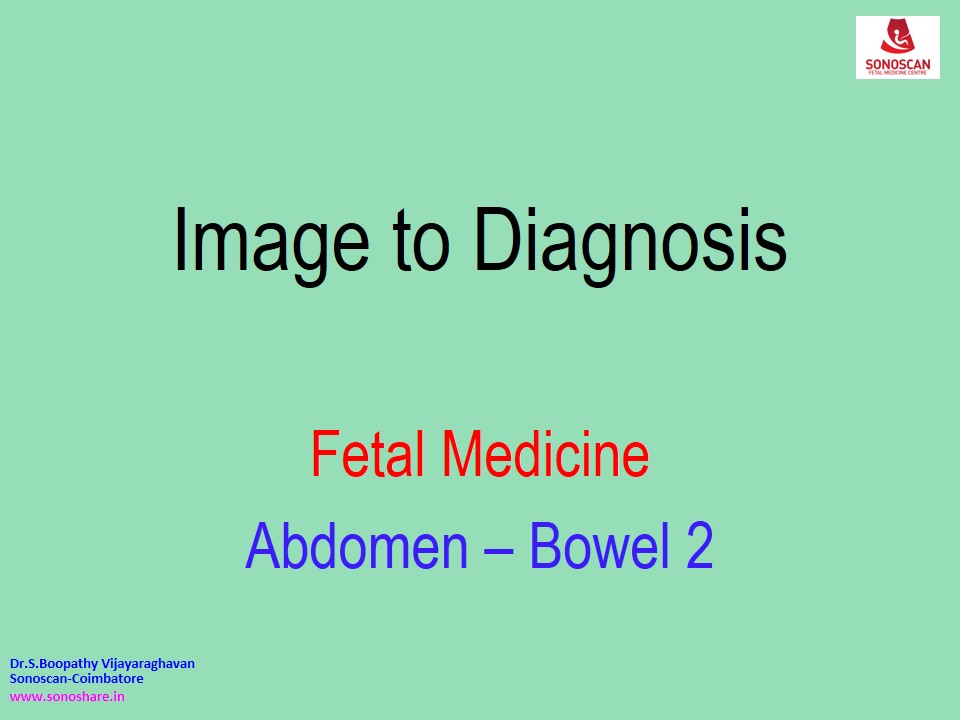 Image to Diagnosis – Fetal Medicine – Bowel - 2