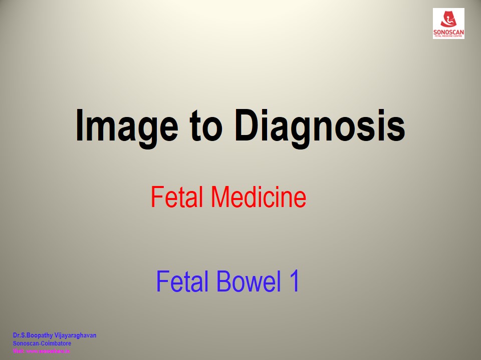 Image to Diagnosis – Fetal Medicine – Bowel - 1
