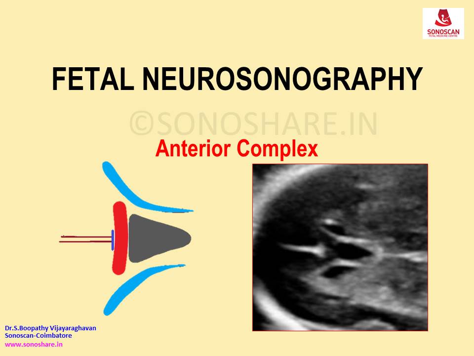 Fetal Neurosonography – Anterior Complex
