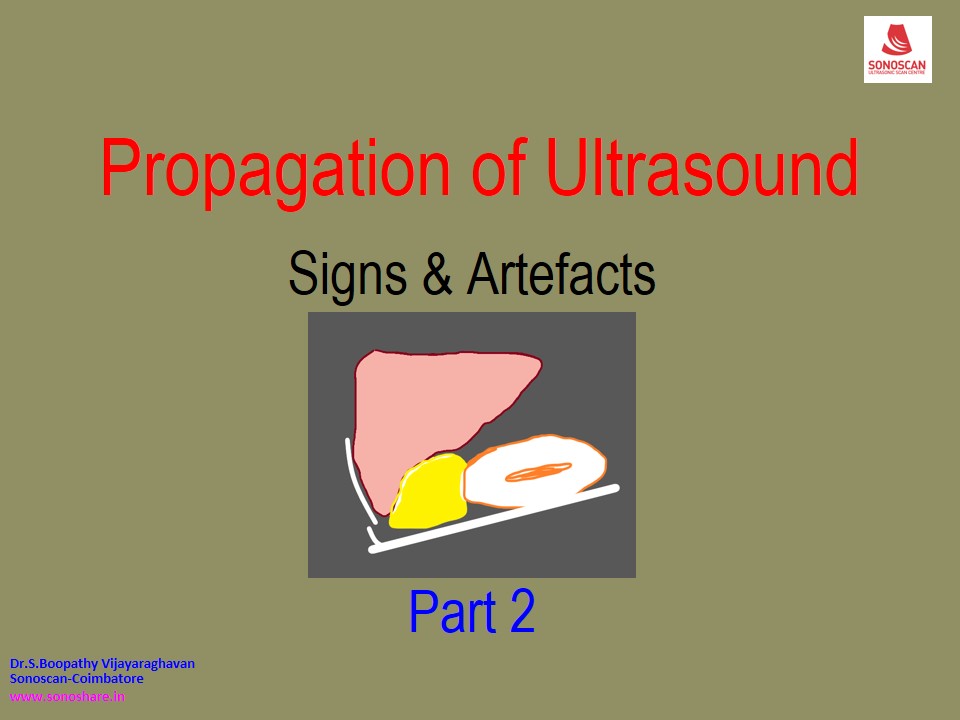 Propagation of Ultrasound – Signs & Artifacts Part 2