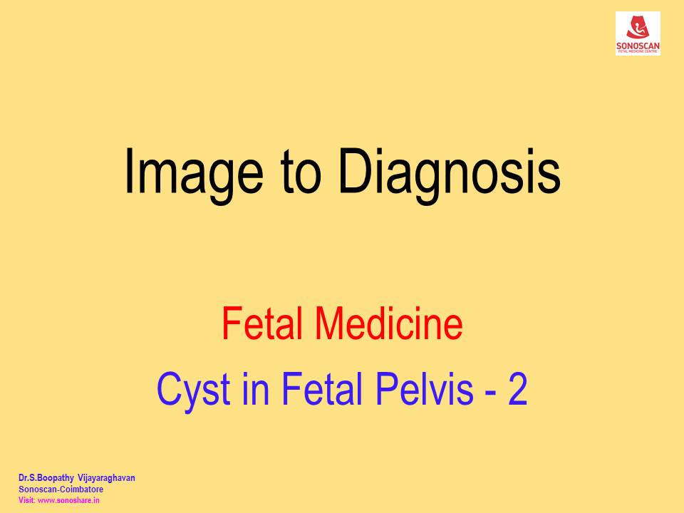 Image to Diagnosis – Fetal Medicine – Cyst in Fetal Pelvis 2