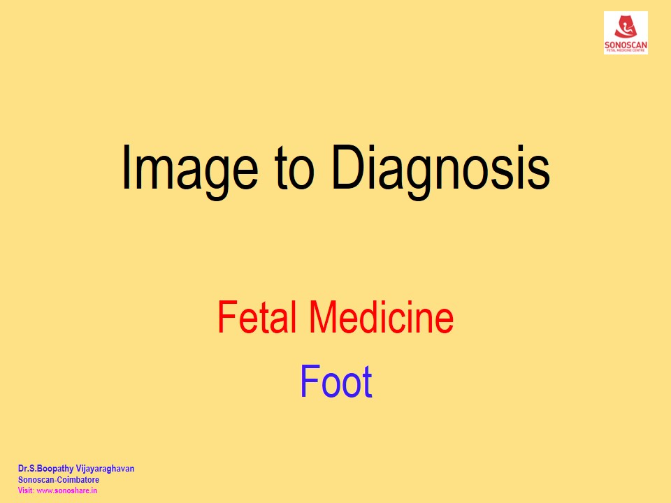 Image to Diagnosis – Fetal Medicine – Foot