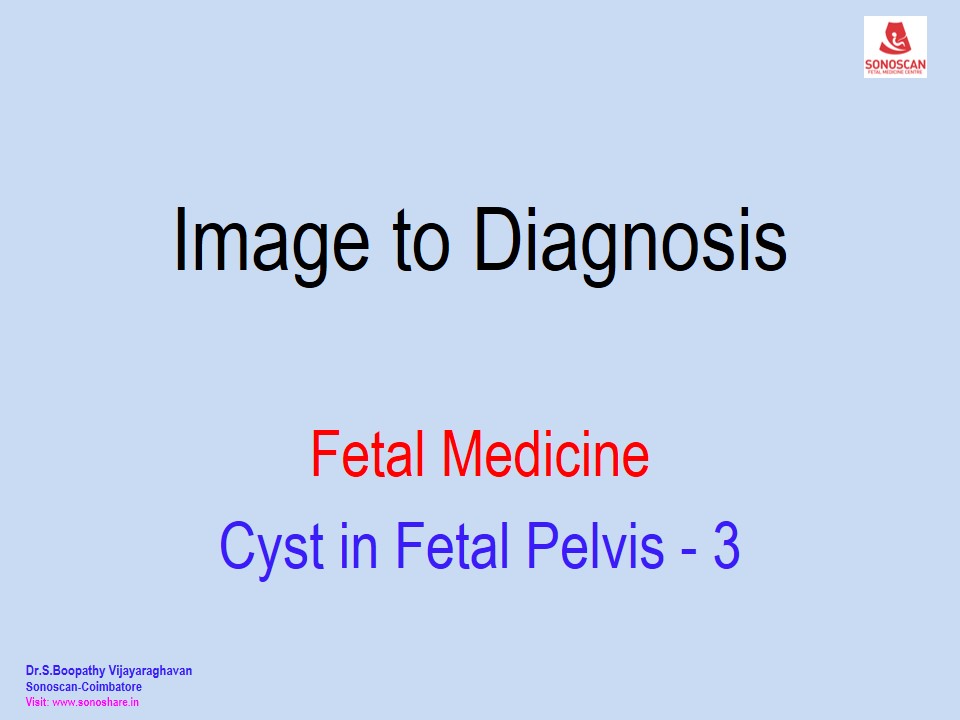 Image to Diagnosis – Fetal Medicine – Cyst in Fetal Pelvis 3