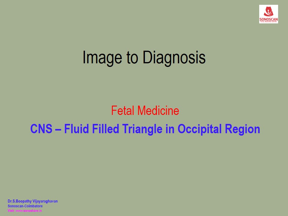 Image to Diagnosis – Fetal Medicine – CNS 1 - Triangular Fluid in PF