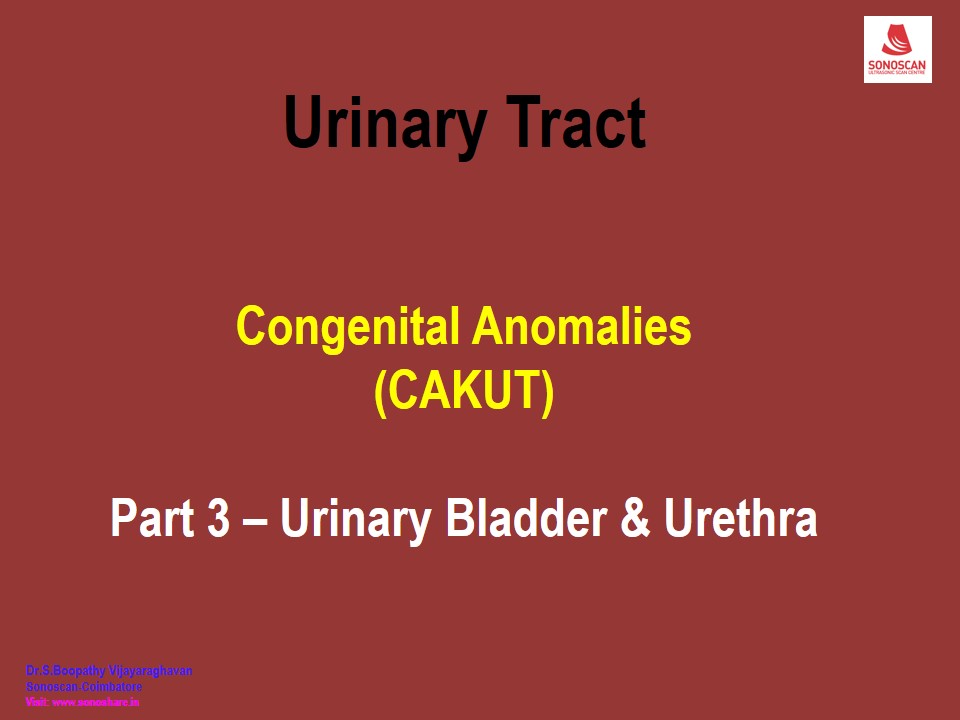 Sonography of Congenital Anomalies in Urinary Tract – Part 3 – Urinary Bladder & Urethra