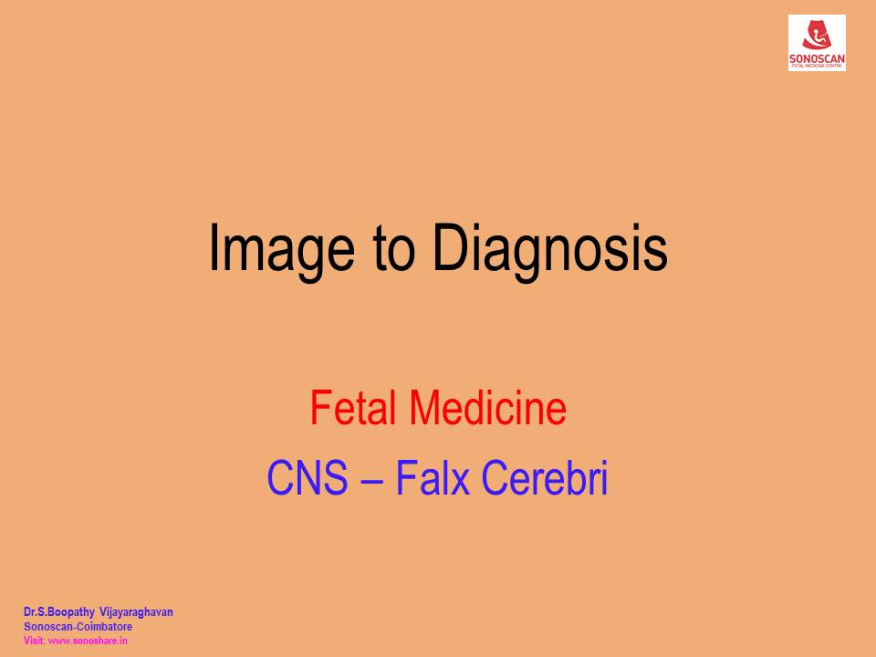 Image to Diagnosis – Fetal Medicine – Falx Cerebri