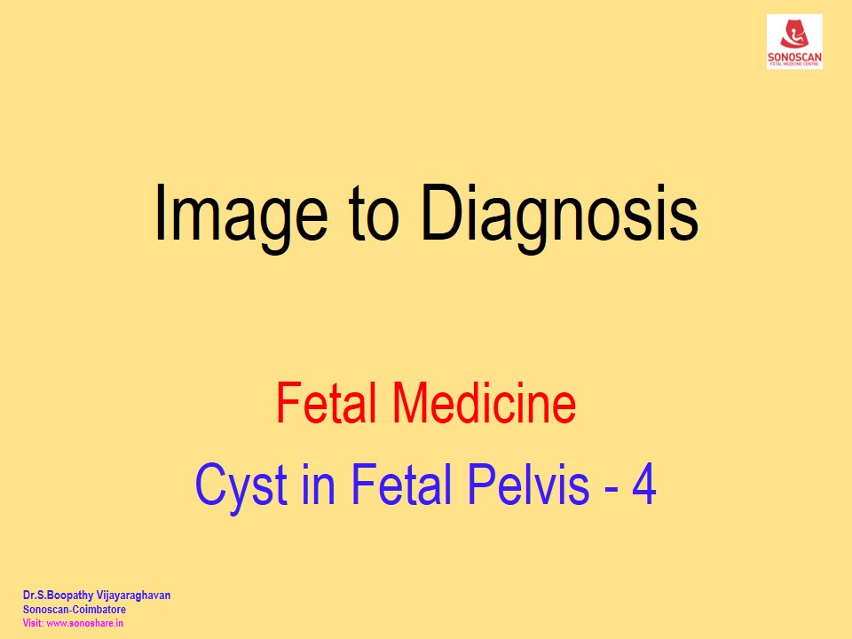 Image to Diagnosis – Fetal Medicine – Cyst in Fetal Pelvis 4
