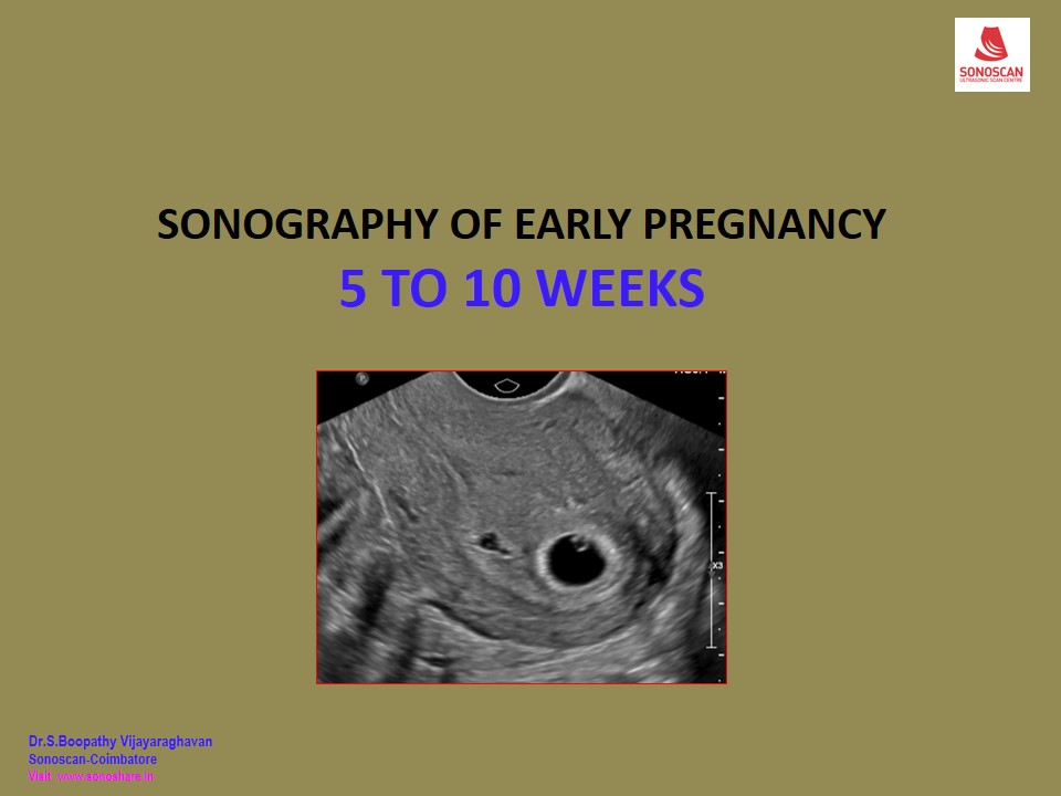 EARLY PREGNANCY – 5to 10 weeks