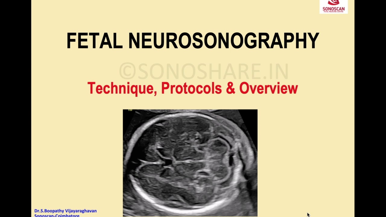 Fetal Neurosonography: Technique, Guidelines & Overview