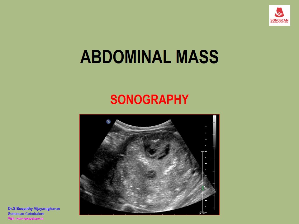 Sonography of Abdominal Mass 2021
