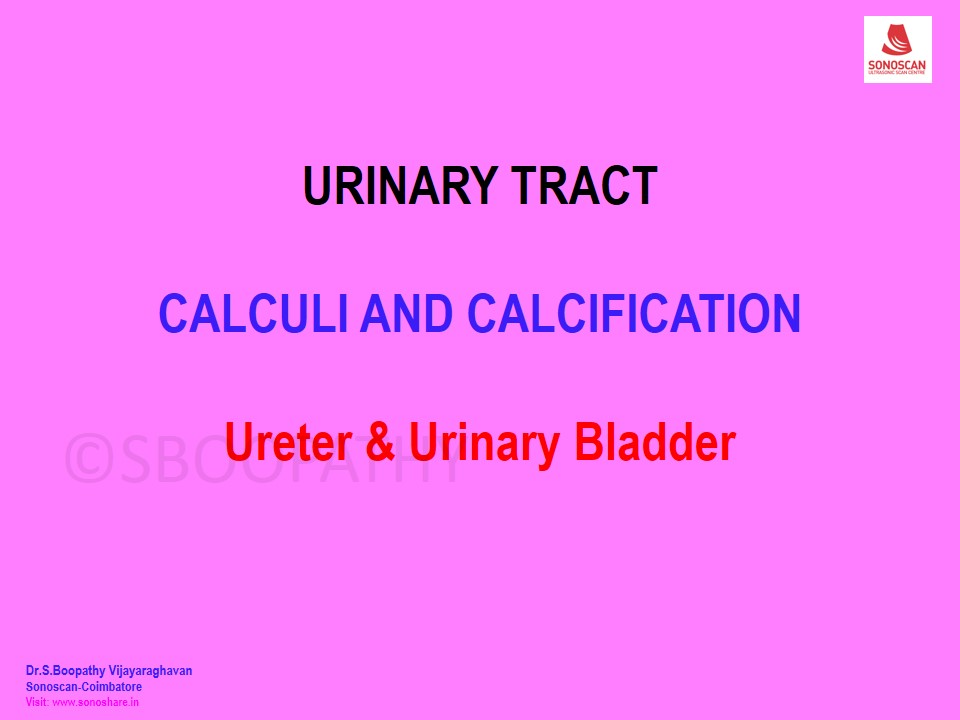Sonography of Calcifications in Urinary Tract – Part 2 – Ureter, Bladder & Urethra
