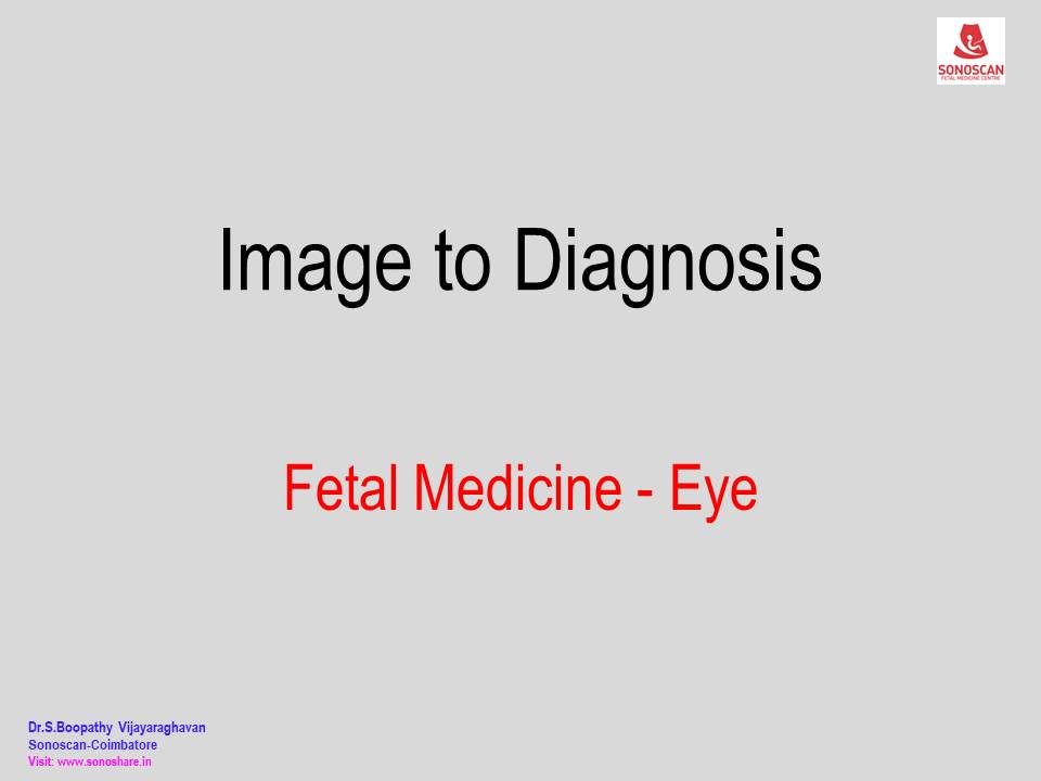Image to Diagnosis – Fetal Medicine – Orbits