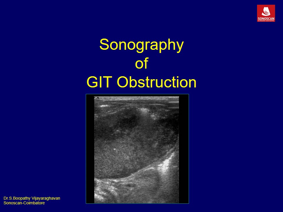 Sonography of Gastrointestinal Tract Obstruction_2020