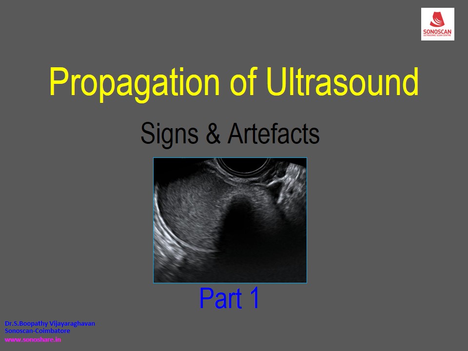 Propagation of Ultrasound – Signs & Artifacts Part 1