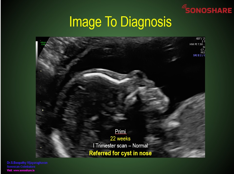 Image to Diagnosis – Fetal Medicine –Face - 1