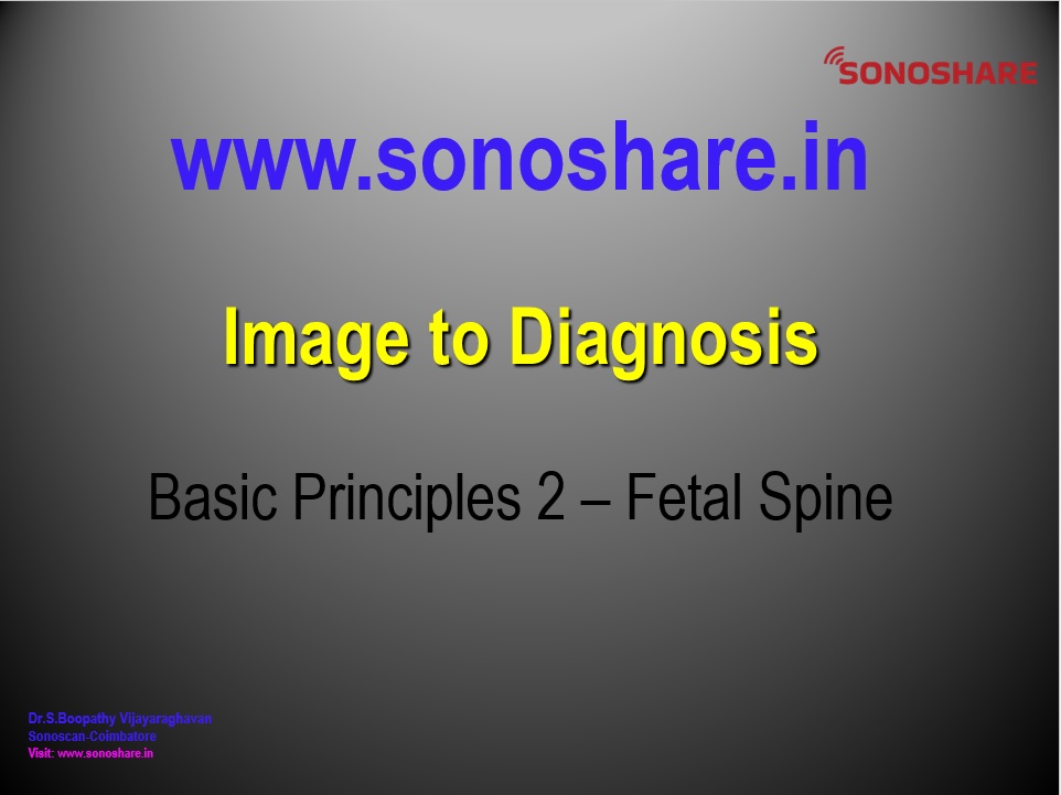 Image to Diagnosis – Fetal Medicine –BASIC_SPINE